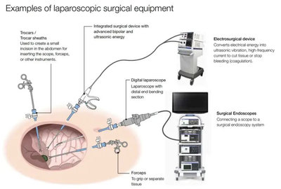 腹腔镜行业分析-贝朗/波士顿科学/康美/强生/卡尔史托斯VS国内厂商